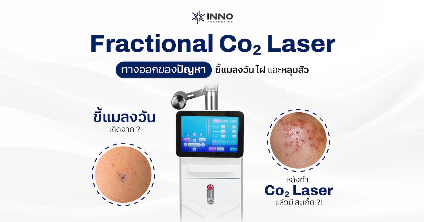 Fractional Co2 Laser ทางออกของปัญหาขี้แมลงวัน ไฝ และหลุมสิว