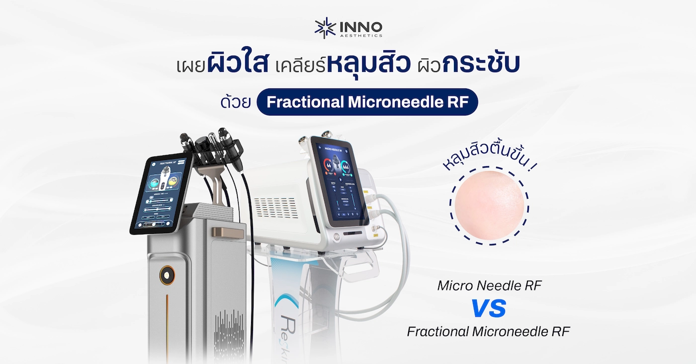 เผยผิวใส เคลียร์หลุมสิว ผิวกระชับด้วย Fractional Microneedle RF